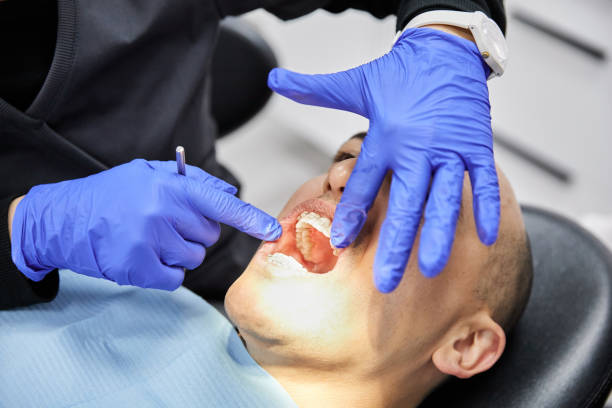 Best Emergency Dentist for Lost Fillings or Crowns in Center Point, AL